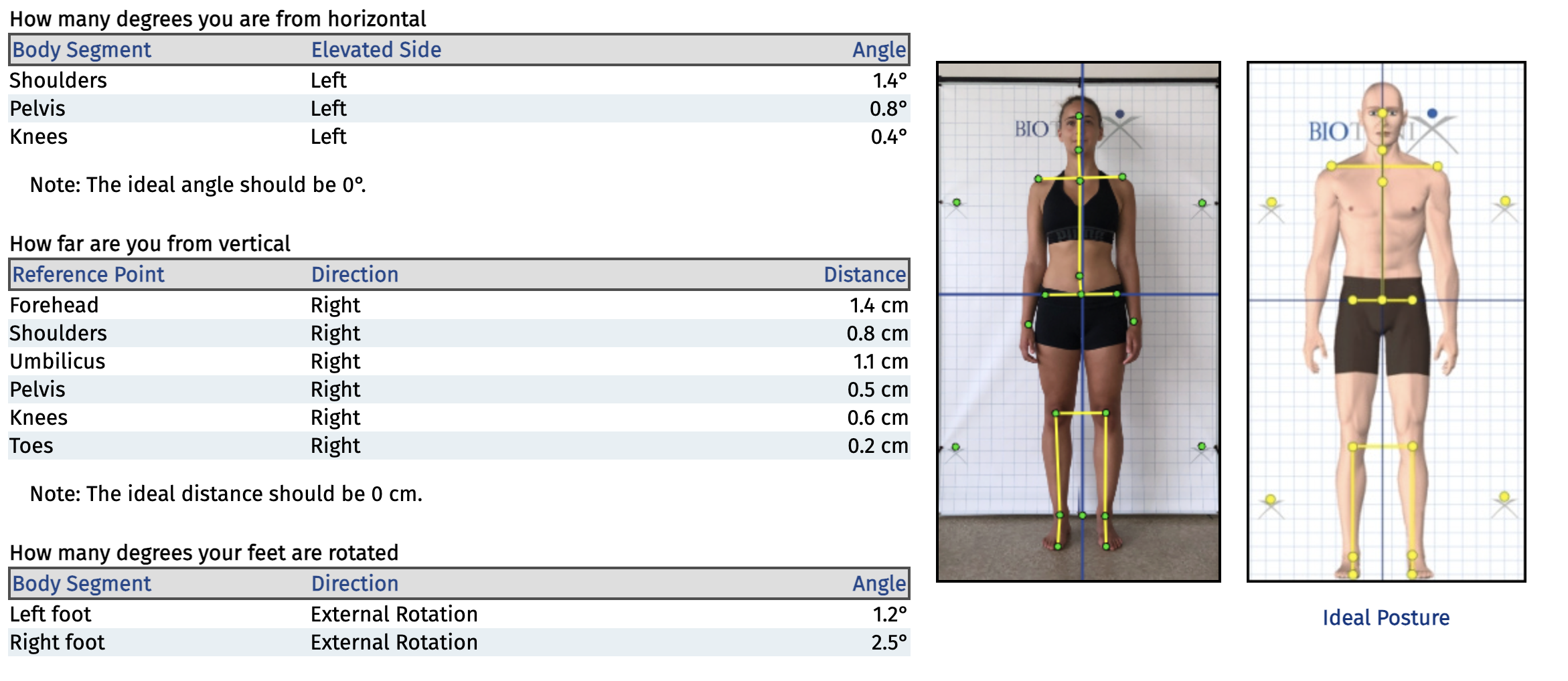 An anterior view of the results obtained from our posture analysis system.