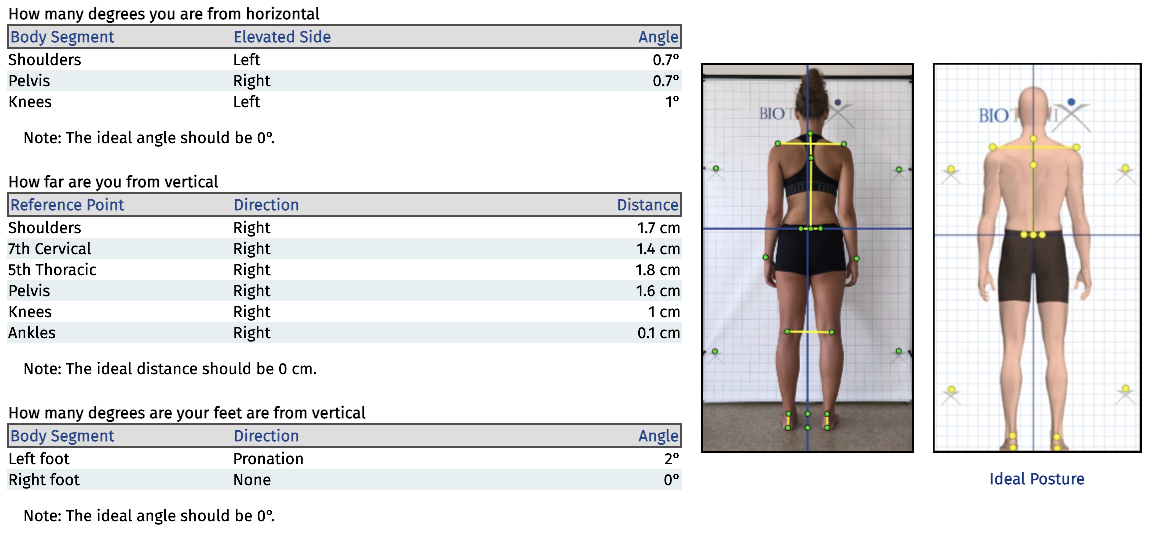 A posterior view of the results obtained from our posture analysis system.